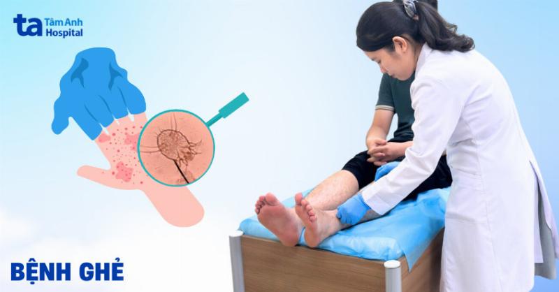 Hình ảnh bệnh ghẻ trên hoa hồng