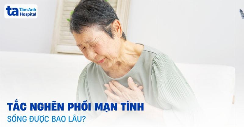 Cac buoc cham soc cay trang nguyen dung cach de keo dai tuoi tho, gop phan giai dap cau hoi cay trang nguyen song duoc bao lau