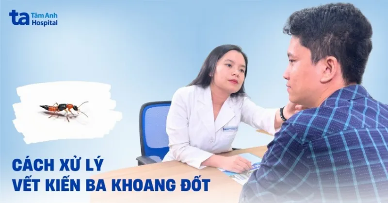 Cách xử lý khi bị kiến ba khoang đốt