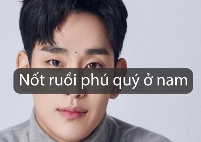 20 nốt ruồi phú quý